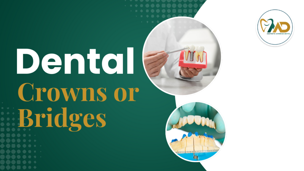 Dental Crowns or Bridges