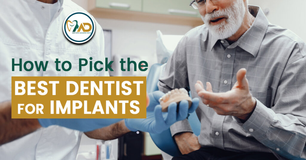 How to Pick the Best Dentist for Implants