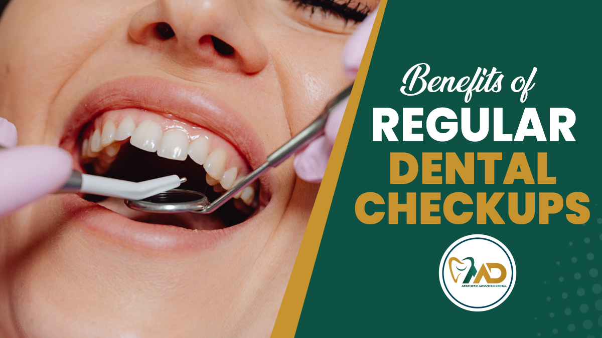 Benefits of Regular Dental Checkups