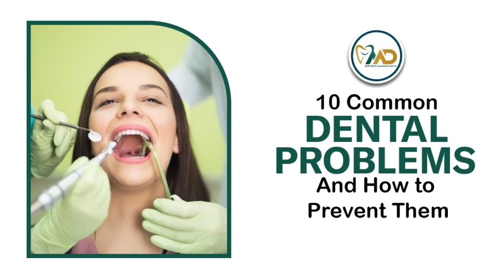 10 Common Dental Problems and How to Prevent Them