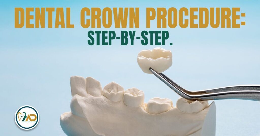 Dental Crown Procedure Step-by-Step.