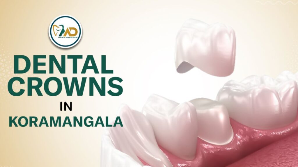 Dental Crowns in Koramangala