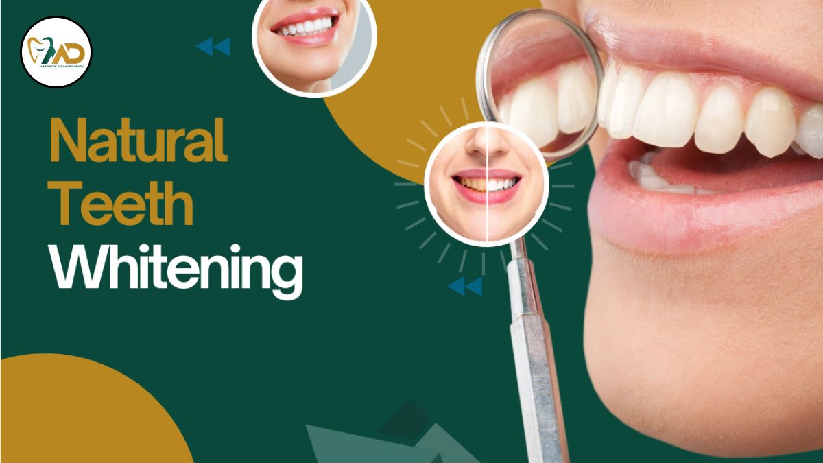 Natural Teeth Whitening