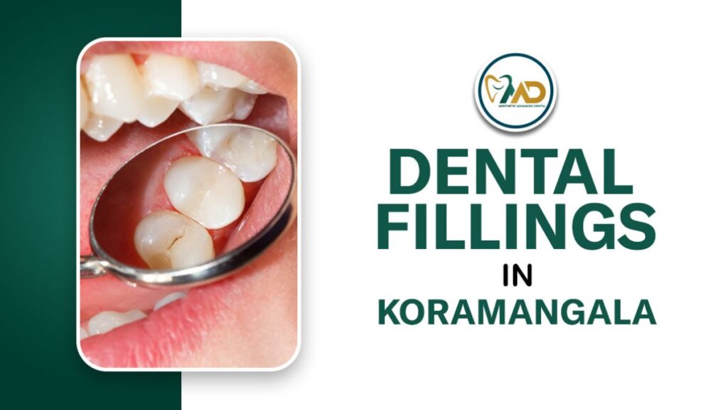 Dental Fillings in Koramangala, Bangalore