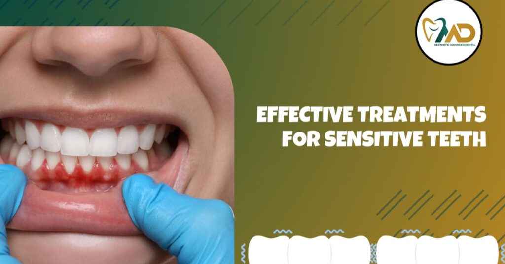 Effective Treatments for Sensitive Teeth