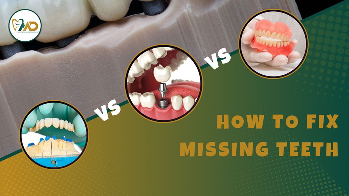 How to Fix Missing Teeth