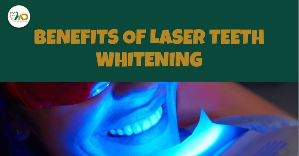 Benefits of Laser Teeth Whitening