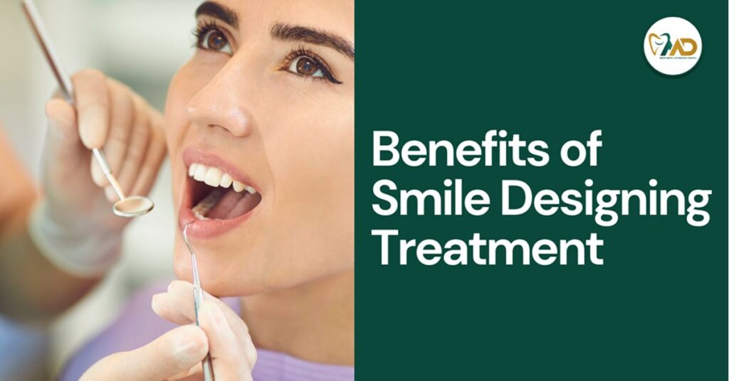 Benefits of Smile Designing Treatment