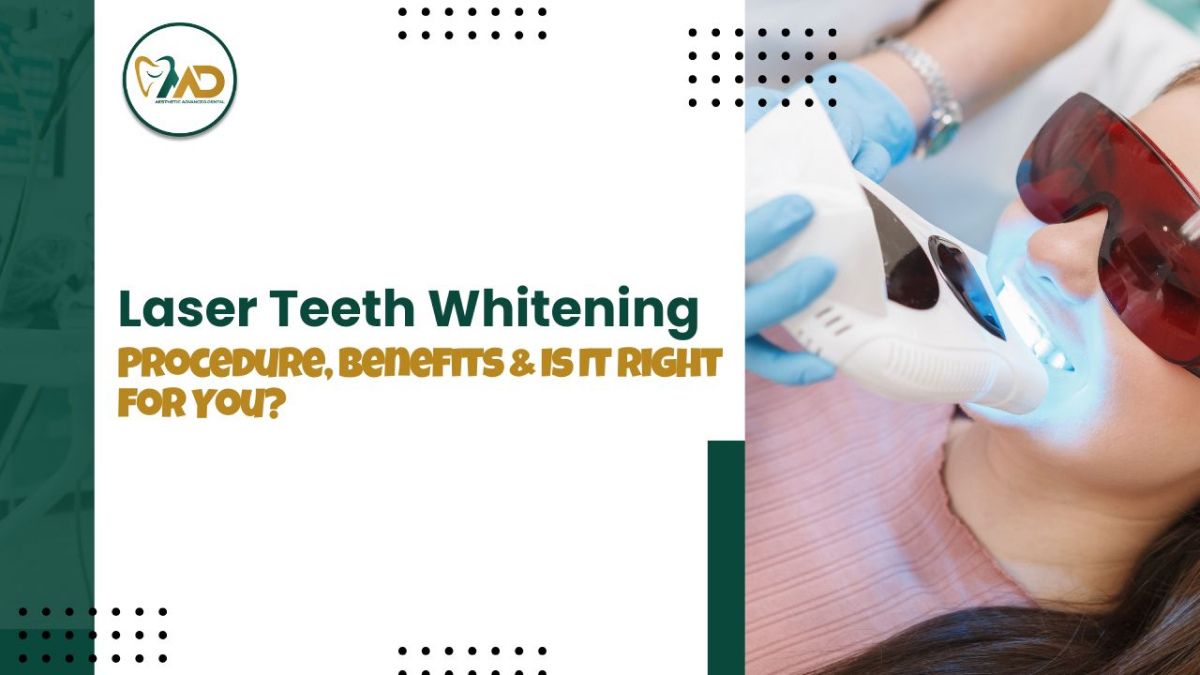 Laser Teeth Whitening